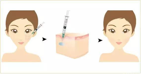 重塑青春容顏的秘密武器，最新除皺科技革新方法揭秘